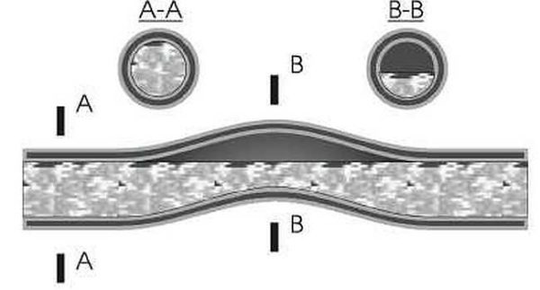 L'aria può accumularsi nelle curve dei tubi