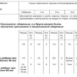 ¿Qué nudos pueden estar en tablas y vigas de diferentes tipos?